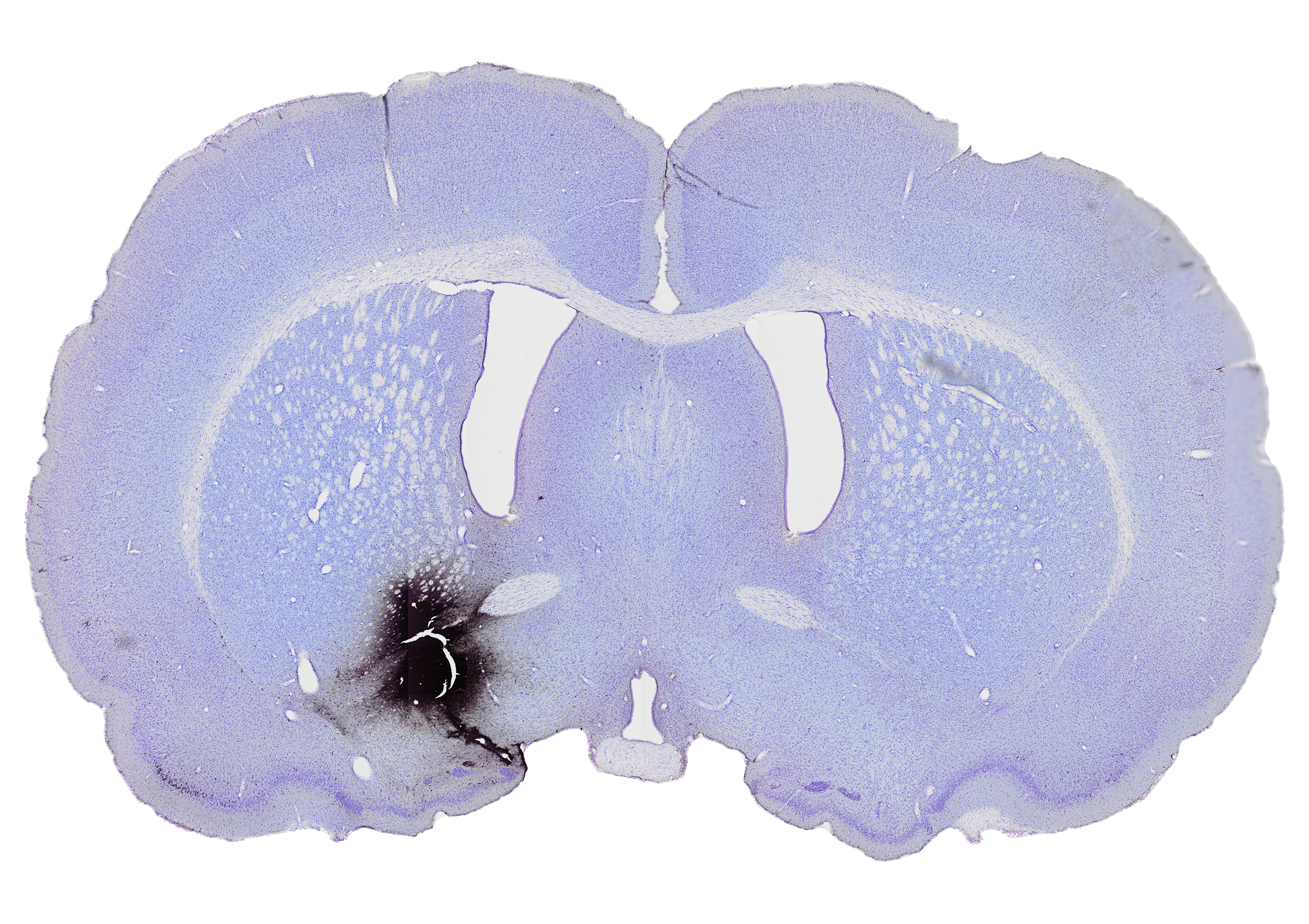 Nucleus Accumbens