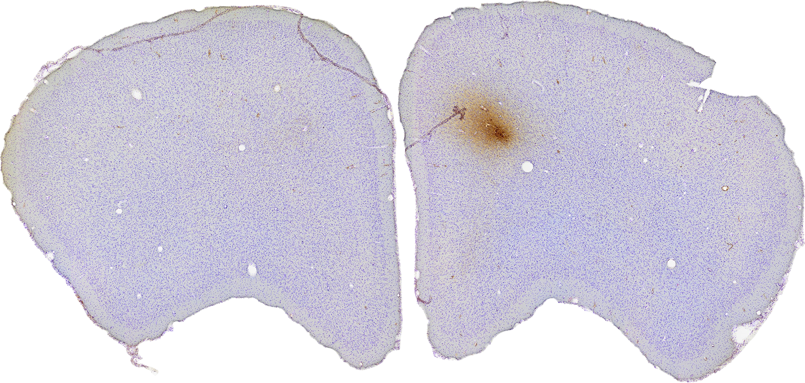 Limbic System